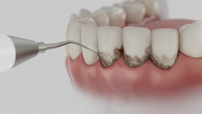 Reliable Dental Implants contractor in Eureka, KS by Smile Center Dentistry